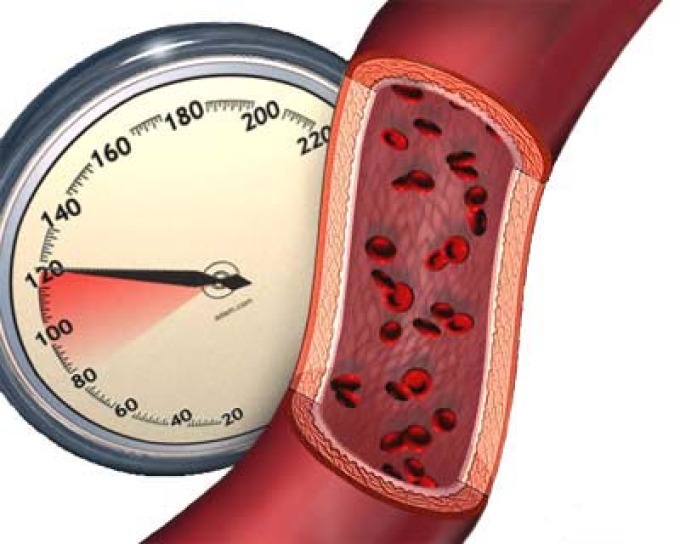 ماذا يعني انخفاض ضغط الدم